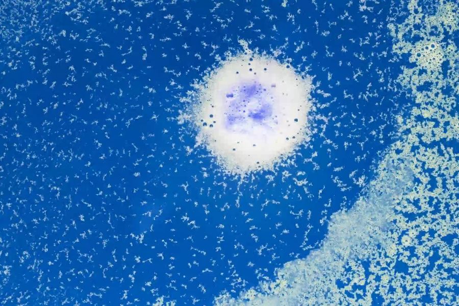 bakteri legionella